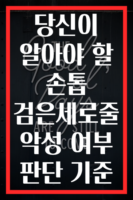 당신이 알아야 할 손톱 검은세로줄 악성 여부 판단 기준