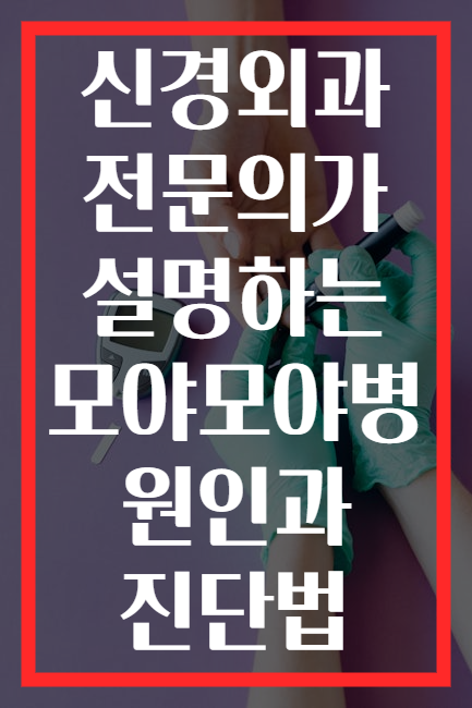 신경외과 전문의가 설명하는 모야모야병 원인과 진단법