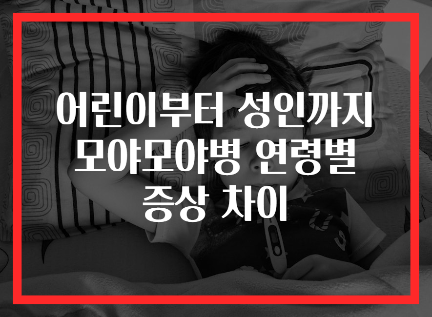 어린이부터 성인까지 모야모야병 연령별 증상 차이