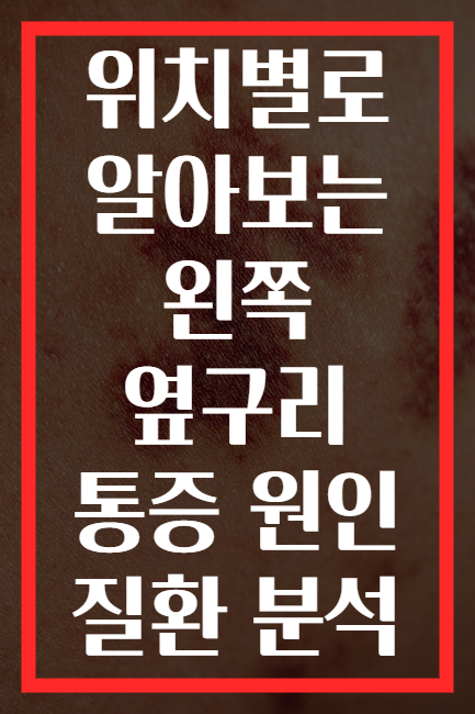 위치별로 알아보는 왼쪽 옆구리 통증 원인 질환 분석