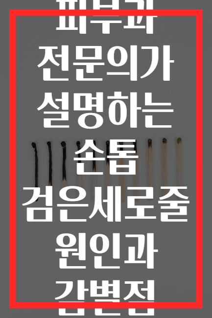 피부과 전문의가 설명하는 손톱 검은세로줄 원인과 감별점